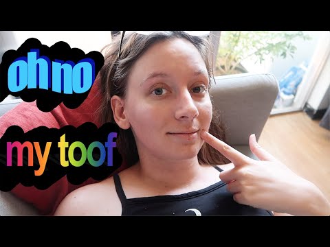 智齒手術後的恢復--東京! (Recovering from Wisdom Tooth Surgery - Tokyo!)