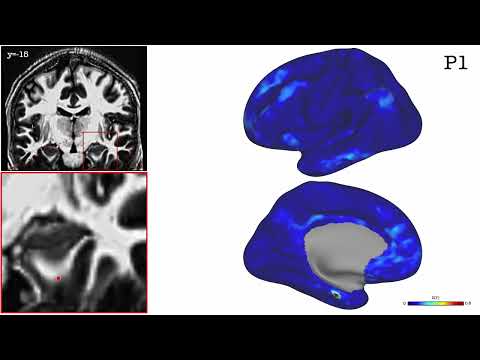 The anatomy of memory: new mnemomic networks discovered in the brain