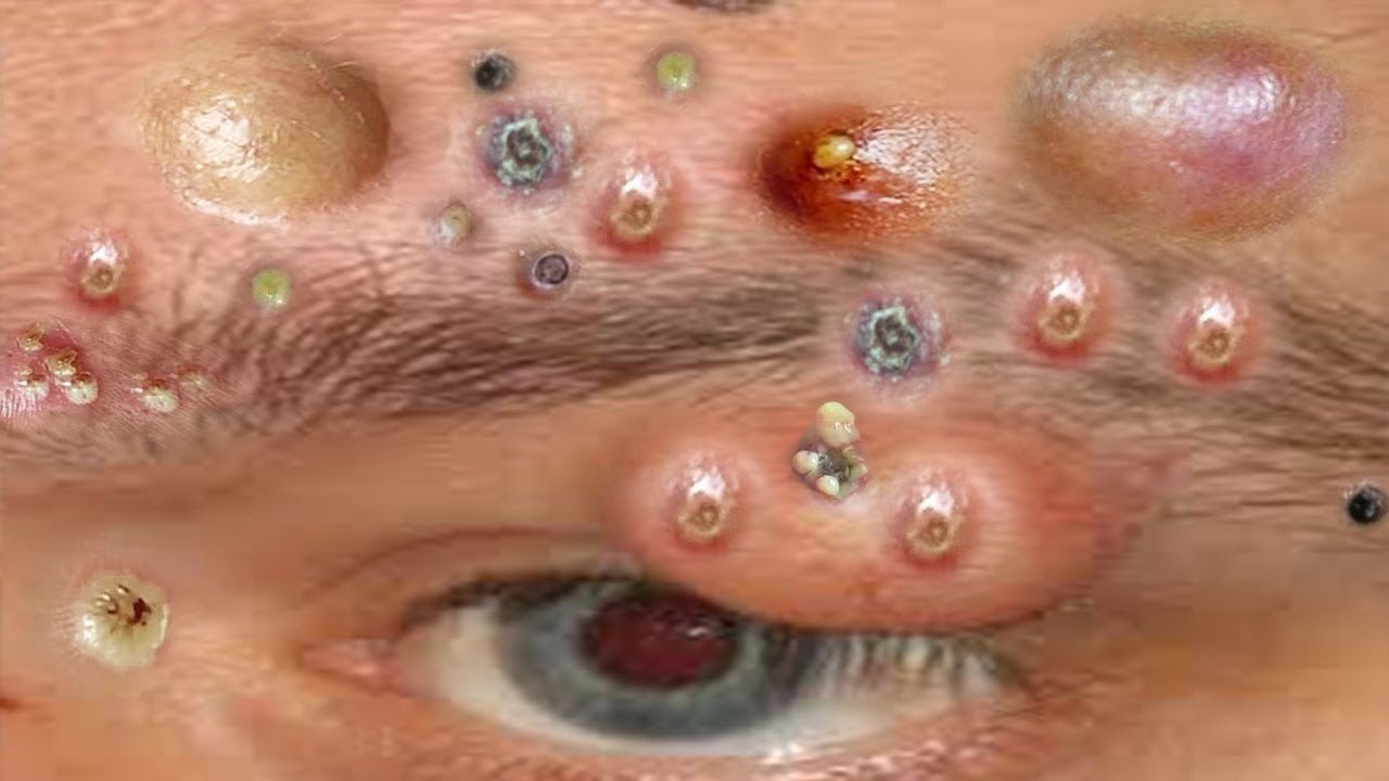 𝑨𝒄𝒉𝒊𝒆𝒗𝒆 𝑰𝒏𝒏𝒆𝒓 𝑷𝒆𝒂𝒄𝒆 𝑾𝒊𝒕𝒉 𝑻𝒉𝒆𝒔𝒆 𝑭𝒂𝒄𝒊𝒂𝒍 𝑪𝒍𝒆𝒂𝒏𝒔𝒊𝒏𝒈 𝑴𝒆𝒕𝒉𝒐𝒅𝒔 #9008396