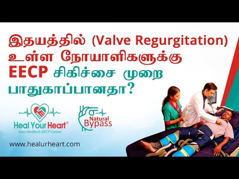 Is EECP Treatment Safe for Patients with Valve Regurgitation?