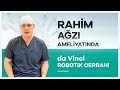 ''da Vinci Robotik Cerrahi'' Sistemiyle Rahim Ağzı Kanseri Doç. Dr. Eralp Başer