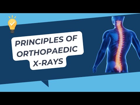 Principles of Orthopaedic X-rays