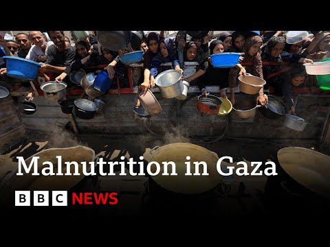 加沙衛生部稱過去 48 小時內有 33 人死於營養不良 | BBC News (Gaza health ministry says 33 people dead from malnutrition in last 48 hours | BBC News)
