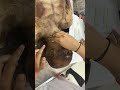 Head And Neck Surface Marking