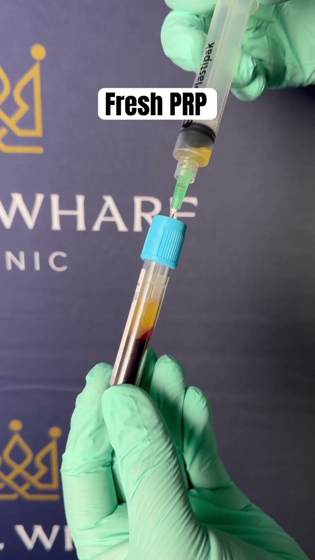 PRP for Hair Growth #prptherapy