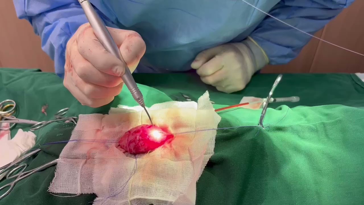 Thumbnail of Veterinary Diode Laser Surgery in Action | PawLaze by Zolar Technology