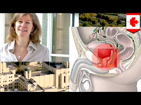Exposition nach Entfernung der Prostata Sie verhindern Prostatitis