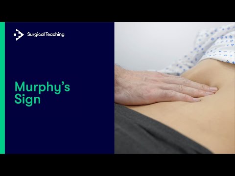 Murphy's sign | What is this Classic Examination Finding?