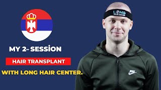 My 2nd session hair transplant with Long Hair Center.