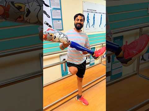Above Knee Prosthetic Cost | Artificial Limbs in Delhi NCR |Ottobock 3R80 | #ossur #3r80 #naklitang