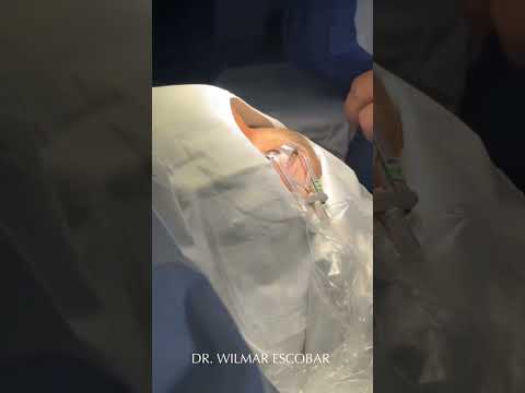 Wilmar Escobar Álvarez-12