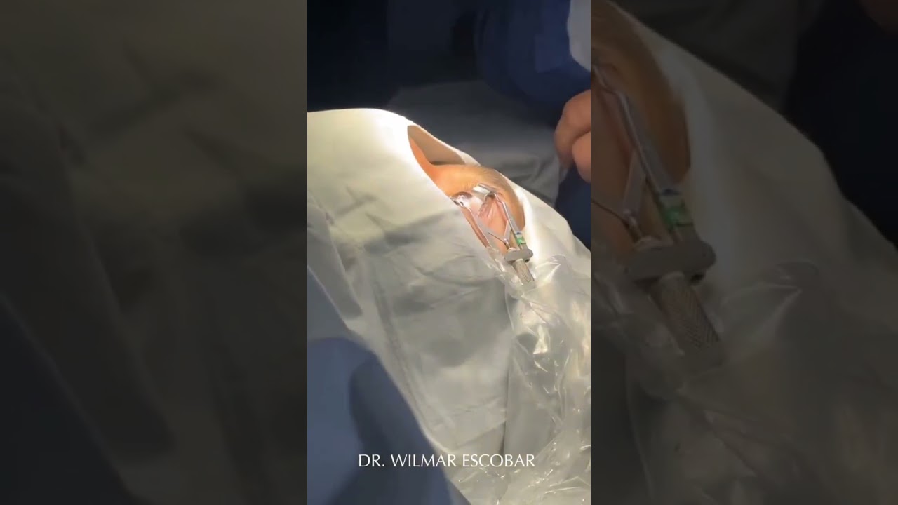 Wilmar Escobar Álvarez-12