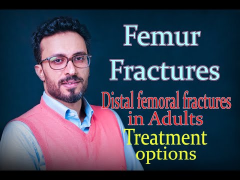 11 Distal femoral fractures: Treatment options