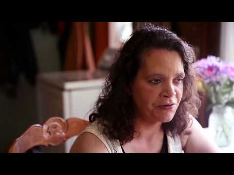 Acute Ischemic Stroke (Story 1)