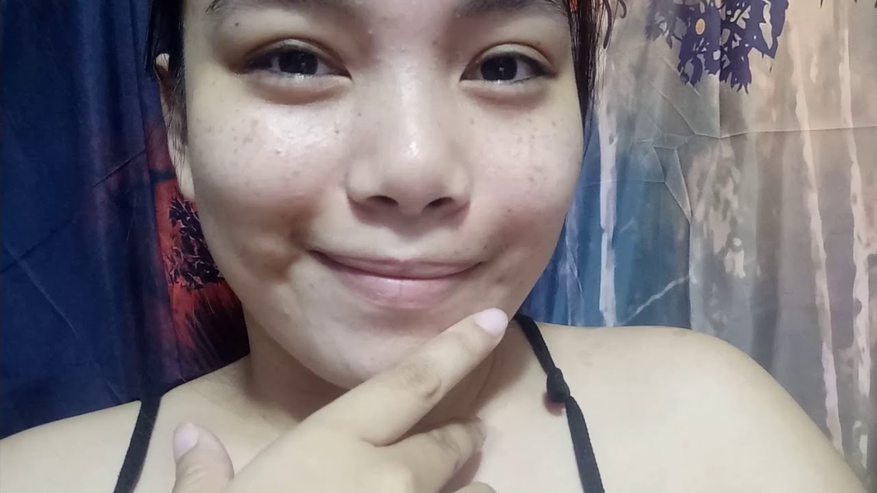 Swollen Face(Namamagang Mukha) day 5th and 6th