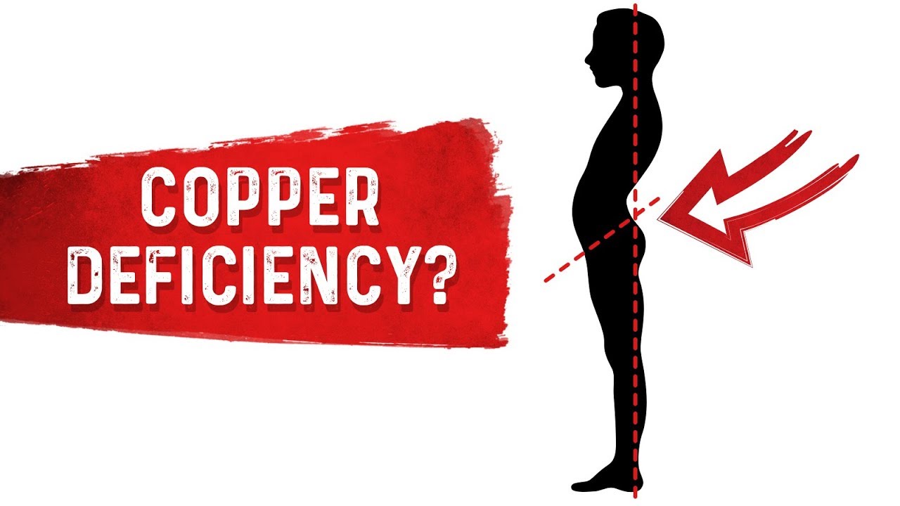 Do You Have a Copper Deficiency? - Dr. Berg - YouTube