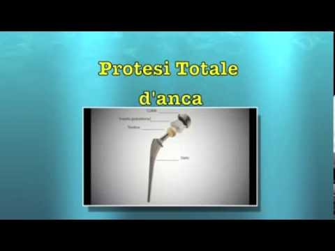 Alcune iniezioni per la lombalgia Artrosi del ginocchio fisioterapia giunto