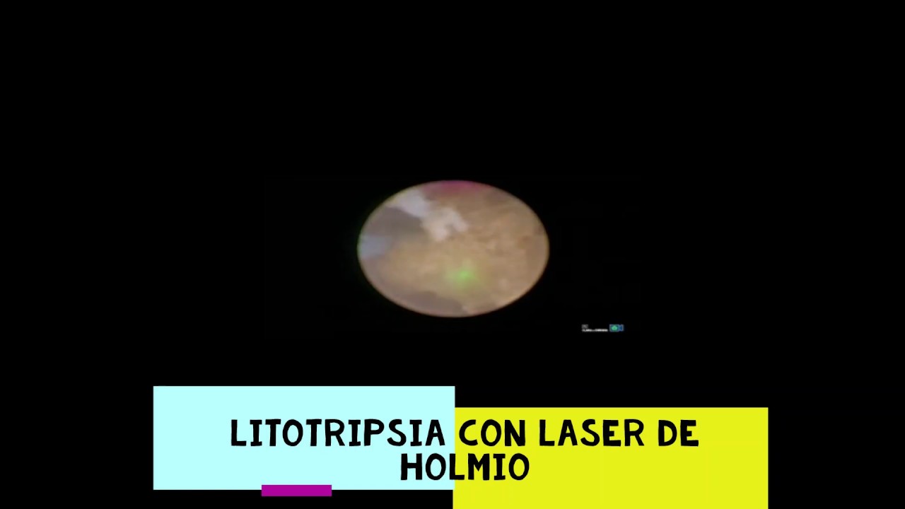 Moisés Alberto Mendoza Sotelo-13