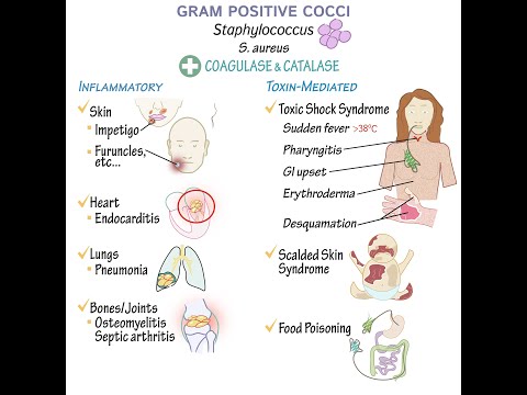 cocci bacillus férfiak kenetében)