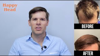 Happy Head Testimonial Video