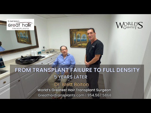Dr. Brett Bolton's MaxHarvest Plus - 5 -Year Hair Transplant Update with Dr. Zafran