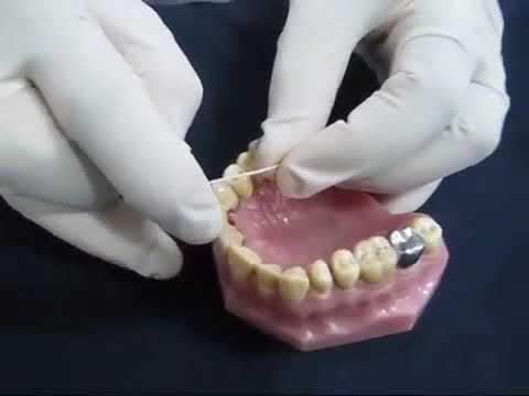 Flossing teeth, Tooth Town Dental Clinic, Nava India, Coimbatore