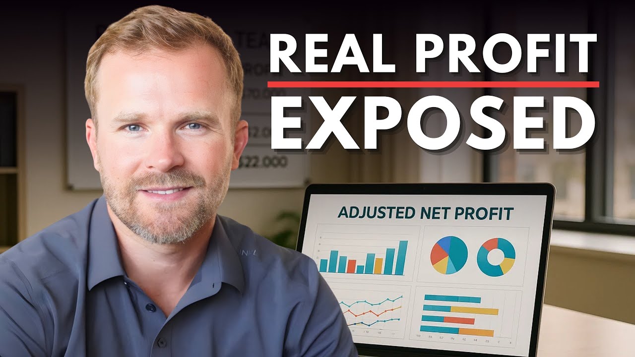 Why Most Team Leaders Miscalculate Profit