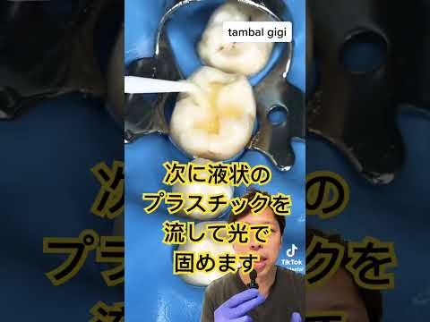 デンタルリウムについて詳しく解説