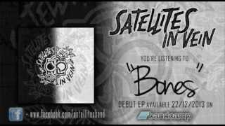 Satellites - "Bones"