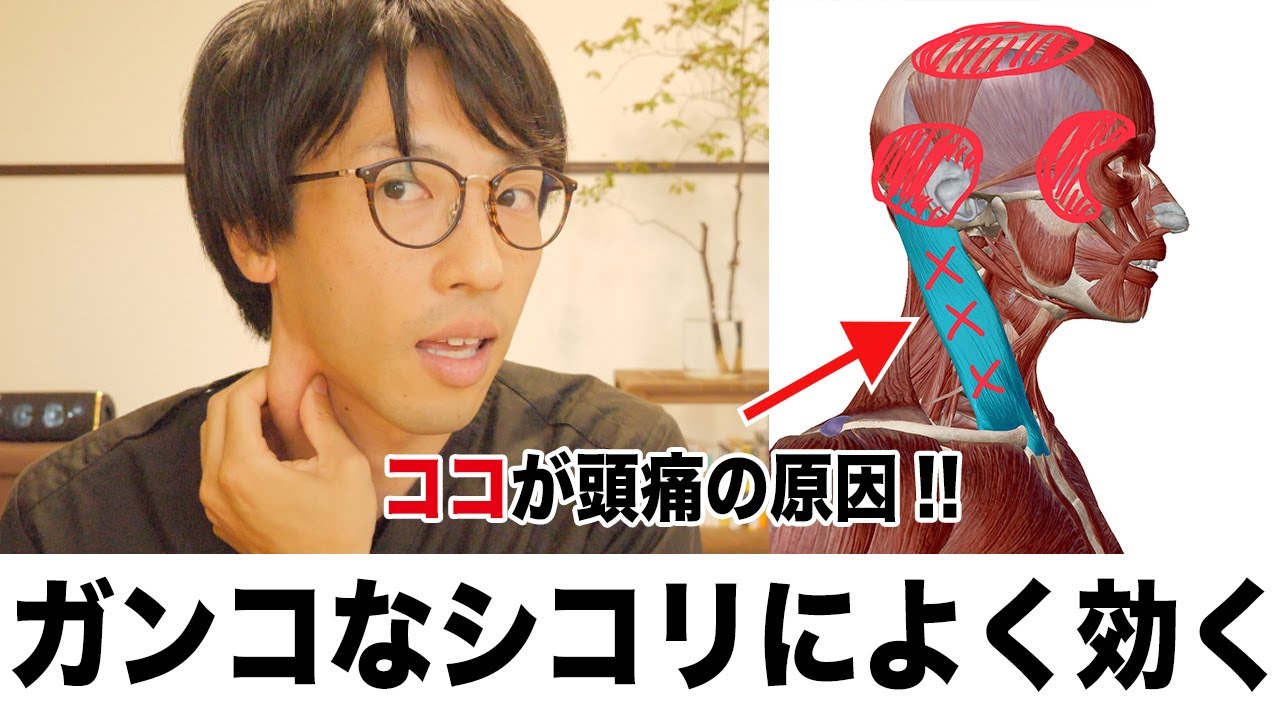 薬で治らない頭痛を改善するセルフマッサージ！胸鎖乳突筋筋膜リリース編【目の奥、おでこ、頭頂部が痛い人へ】