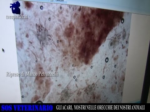 Nanoplastyr sul ginocchio Articolazioni gonfie spesso