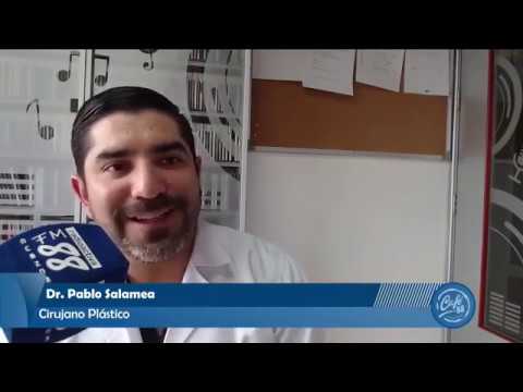 Estuvimos hablando en Radio FM88 Sobre la cirugía de párpados