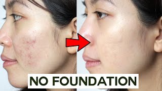 How to Cover Acne & Blemishes WITHOUT Foundati