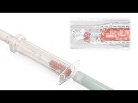 download lagu mp3 mp4 Bone Trap Dentsply, download lagu Bone Trap Dentsply gratis, unduh video klip Bone Trap Dentsply