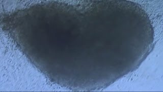 Can we ever mend a broken heart?