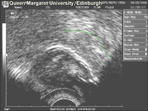 Covert contrast - rhoticity in Scottish English