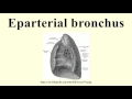 Eparterial bronchus