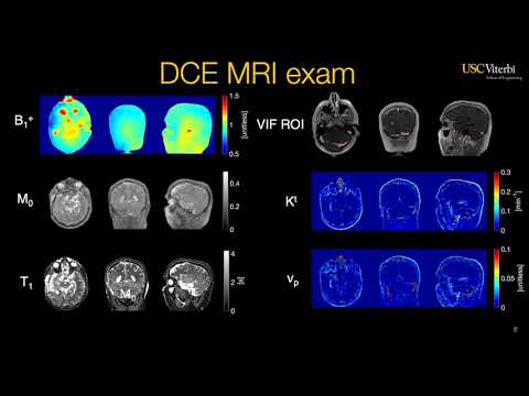 Yannick Bliesener | Pseudo Test-Retest Evaluation of Sparse DCE-MRI of Brain Tumor
