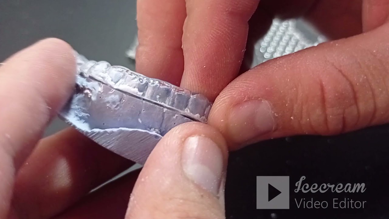 COMO HACER UNA GUARDA DENTAL PASO A PASO