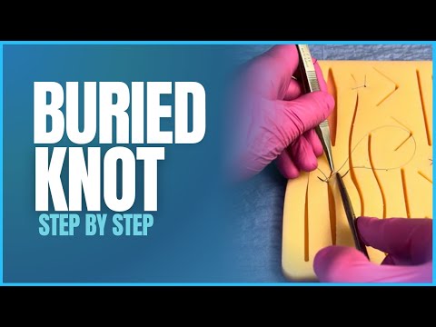 Simple Buried Suture (Deep Dermal Stitch) – Step-by-Step Demo