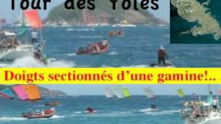 preview picture of video 'Doigts Arrachés Jeune Fille Tour des Yoles 2009 Martinique'