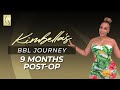 Kimbella S BBL 9 Month Post Op Brazilian Butt Lift Before After By Dr Mehio At Mia Aesthetics