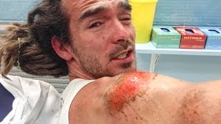 BRUTAL SKATING ACCIDENT