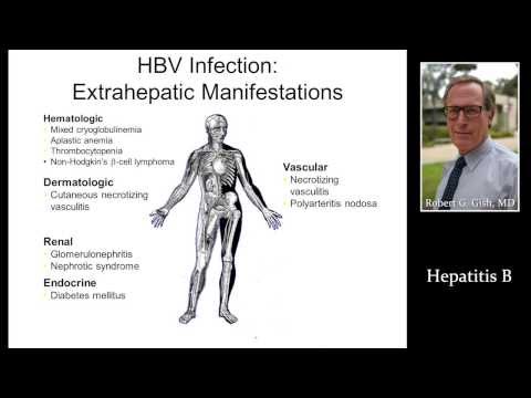 HEPATITIS B (HBV) by Dr. Robert Gish