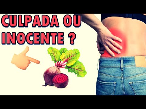 Pedras nos RINS: Posso comer Beterraba ?
