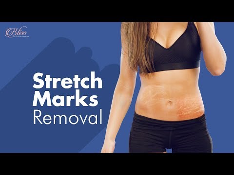 Stretch Mark Combination Therapy