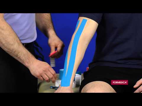 comment appliquer kinesio taping