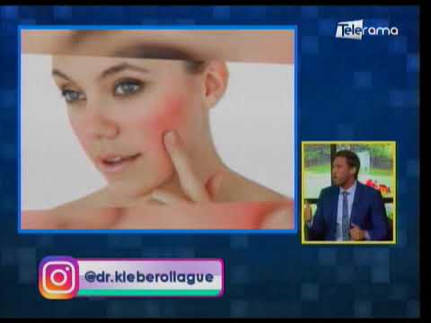 La rosácea: Una enfermedad crónica que afecta la piel 