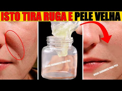 ISTO TIRA RUGA E PELE VELHA: Aplique este Removedor de RUGA - Elimine a FLACIDEZ, MELASMA e MANCHAS.