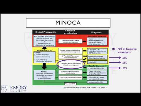 A Case of Myocardial Mimicry, An Anginal Story